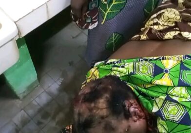 Tchad : Sarh : un fils s’en prend à sa mère à coups de hache, la victime entre la vie et la mort