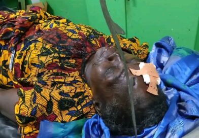 Tchad:  Sarh : Une femme grièvement blessée à l’œil par son époux au quartier Kamati