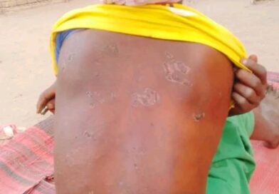 Tchad : à 17 ans, elle voulait aller à l’école, son père l’a brisée pour un mariage forcé à Dilli