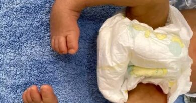 RDC : Près de 900 enfants nés avec un pied bot pris en charge gratuitement en 9 mois RDC : Près de 900 enfants nés avec un pied bot pris en charge gratuitement en 9 mois